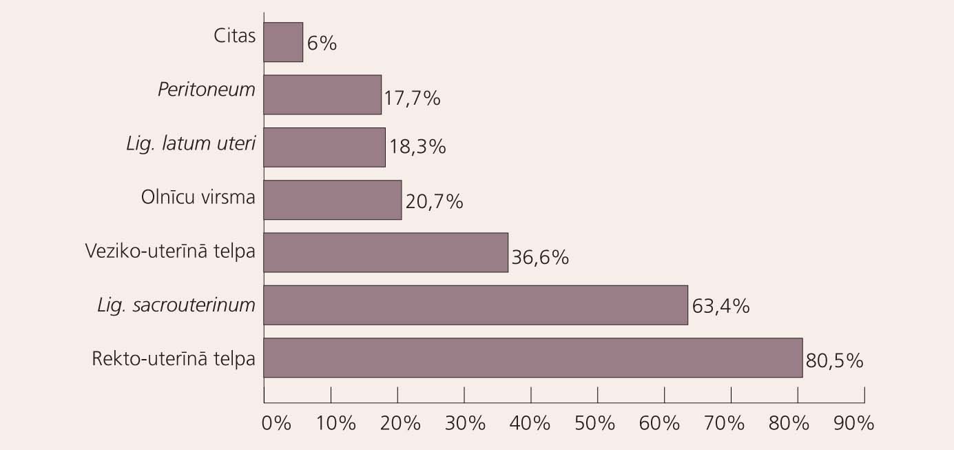 Endometriozes perēkļu lokalizāciju sadalījums pētījuma grupā (%)