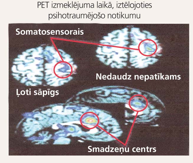 Raksturīgākās aktivitātes pacienta galvas smadzenēs