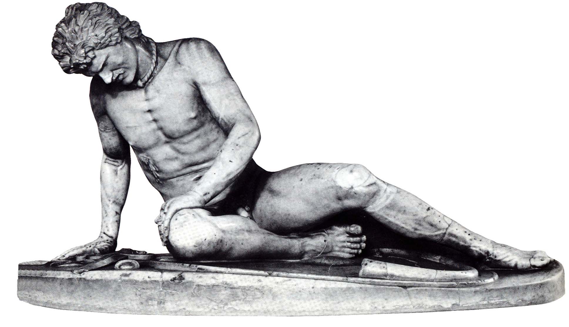 Mirstošs gladiators. [9] Galēns Pergamā bija ārsts gladiatoru skolā un iepazinās ar traumu un ievainojumu dziedināšanu