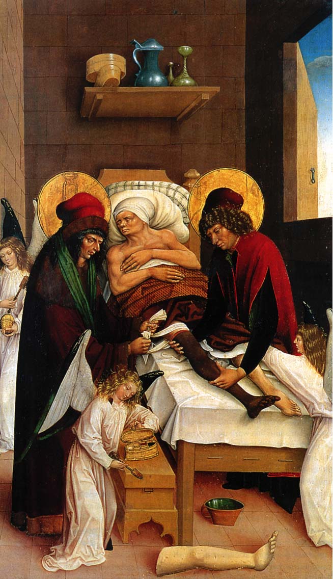 Svētie – brāļi Kosma un Damiano – transplantē līķa kāju slimajam baznīcas kalpam. Ap 1500. gadu. (Württembergisches Landesmuseum, Stuttgart)