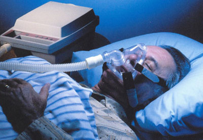 Miega apnoja bieži sastopama problēma insulta pacientiem