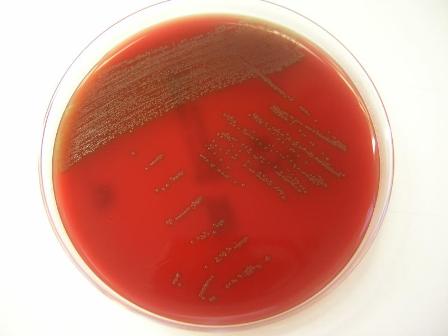 Streptococcus tigurinus kolonijas