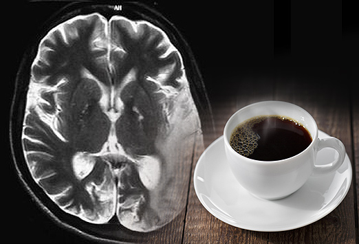 Kafija ne tikai pamodina, bet arī palīdz samazināt depresijas un insulta risku