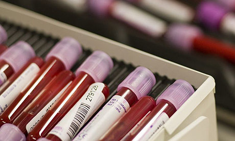 Jauns asins tests ļauj prognozēt pēkšņas nāves risku