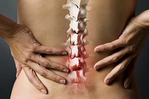 Smēkētājiem neefektīva muguras sāpju ārstēšana