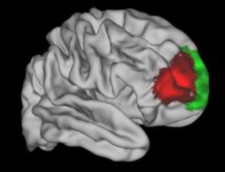 Cilvēka galvas smadzenes