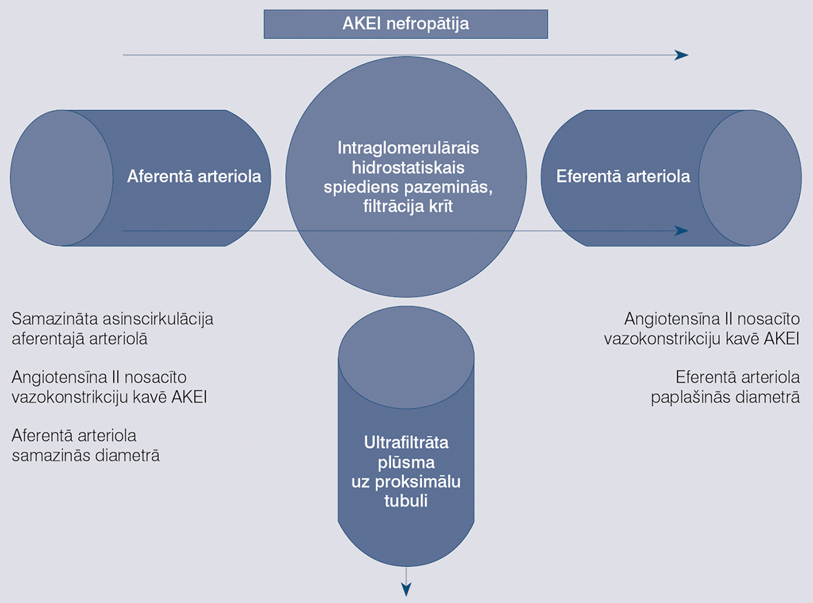 Angiotensīnu konvertējošā enzīma inhibitora (AKEI) izraisīta nefropātija [4]