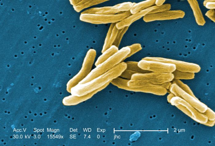 Pagājušogad reģistrēta zemākā saslimstība ar tuberkulozi pēdējā 21 gada laikā