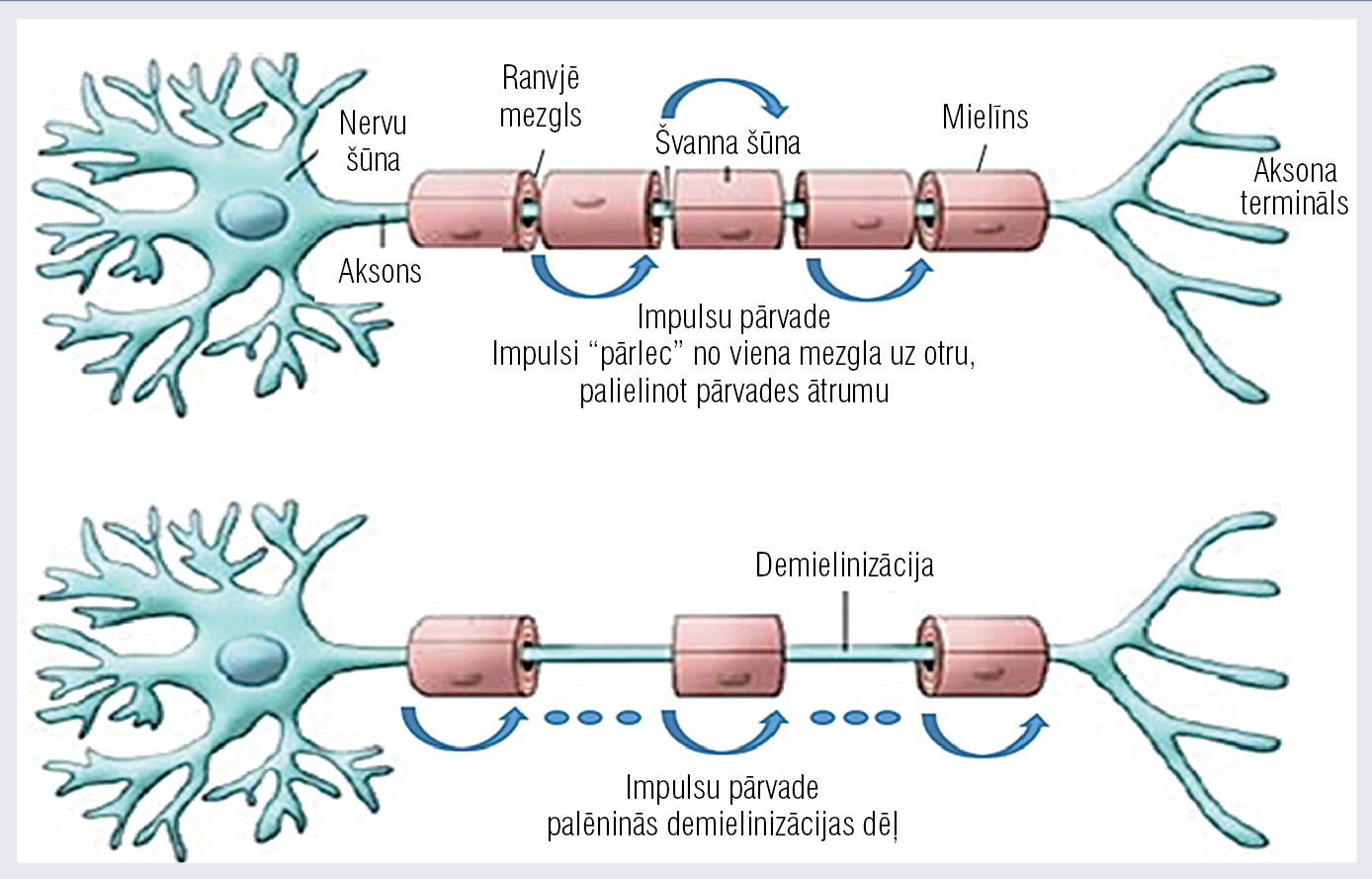 Mielinizētās (A) un demielinizētās (B) perifērās nervu sistēmas nervu šķiedras [33]