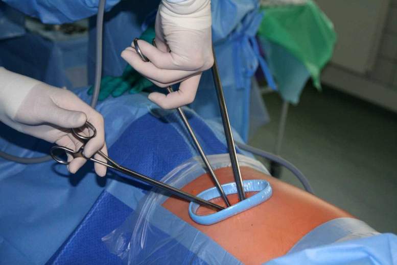 Austrumu slimnīcā pirmo reizi Latvijā caur „atslēgas caurumu” izņem vēža skartu plaušu