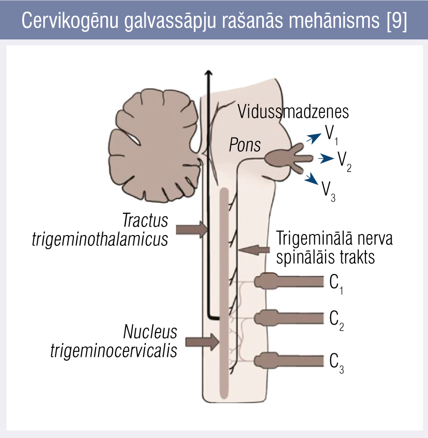 Cervikogēnu galvassāpju rašanās mehānisms [9]