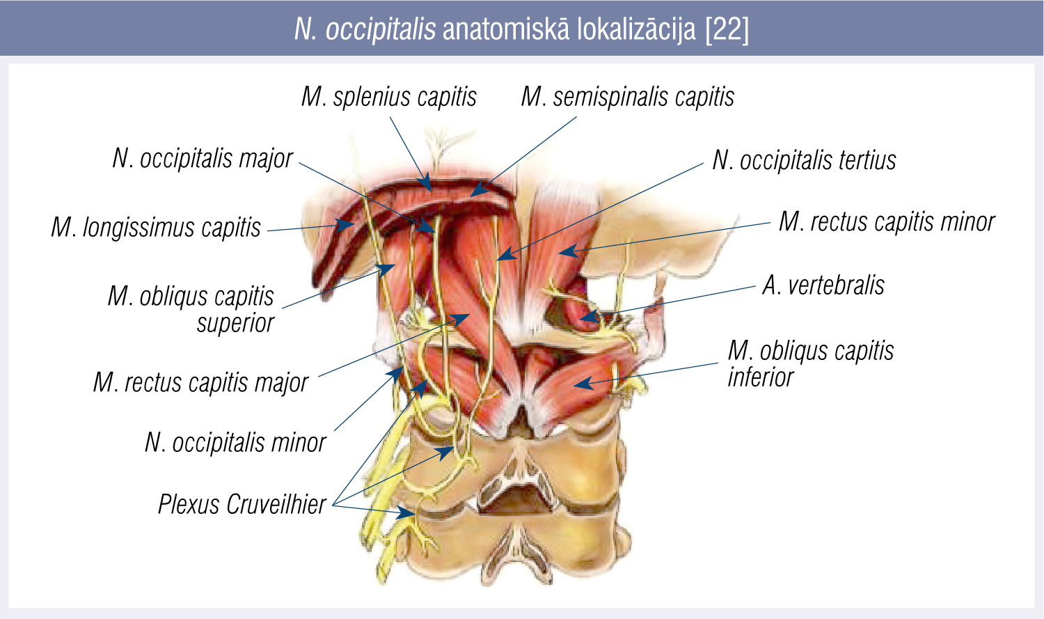 N. occipitalis anatomiskā lokalizācija [22]
