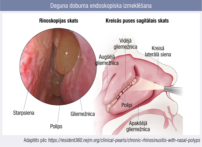 Deguna dobuma endoskopiska izmeklēšana