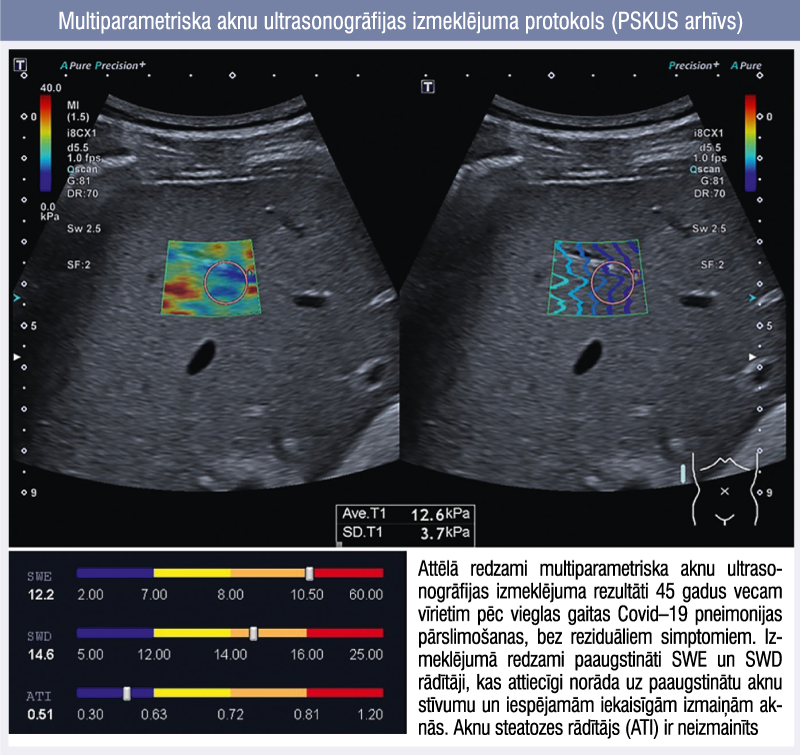 Multiparametriska aknu ultrasonogrāfijas izmeklējuma protokols (PSKUS arhīvs)