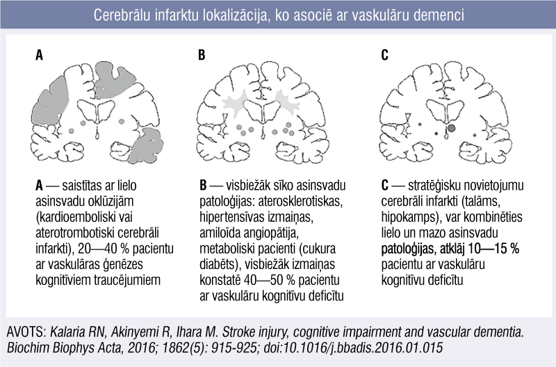 Cerebrālu infarktu lokalizācija, ko asociē ar vaskulāru demenci