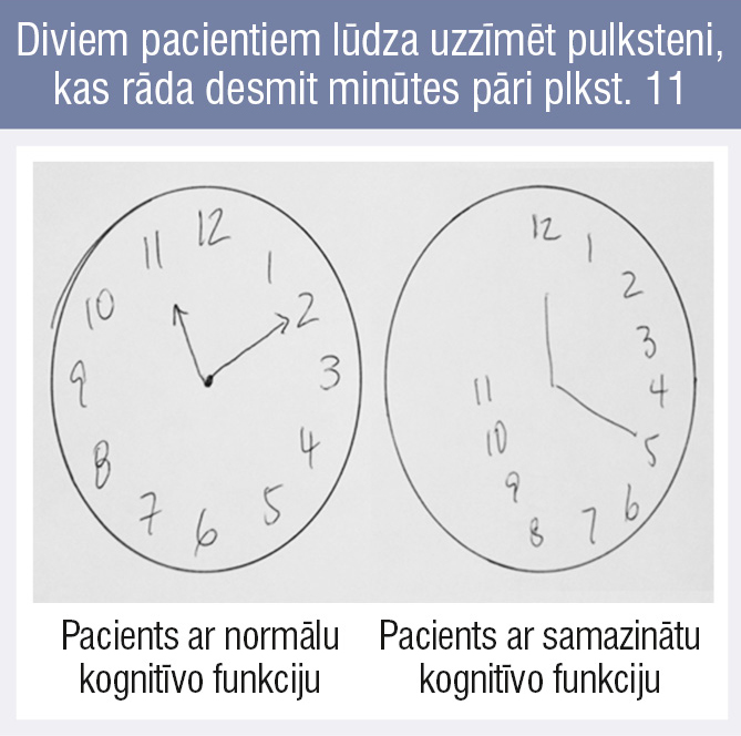 Diviem pacientiem lūdza uzzīmēt pulksteni, kas rāda desmit minūtes pāri plkst. 11