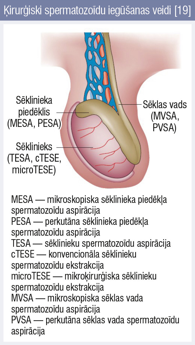 Ķirurģiski spermatozoīdu iegūšanas veidi [19]