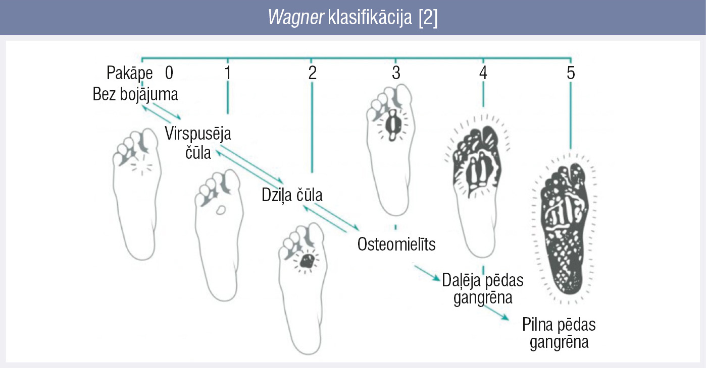 Wagner klasifikācija [2]