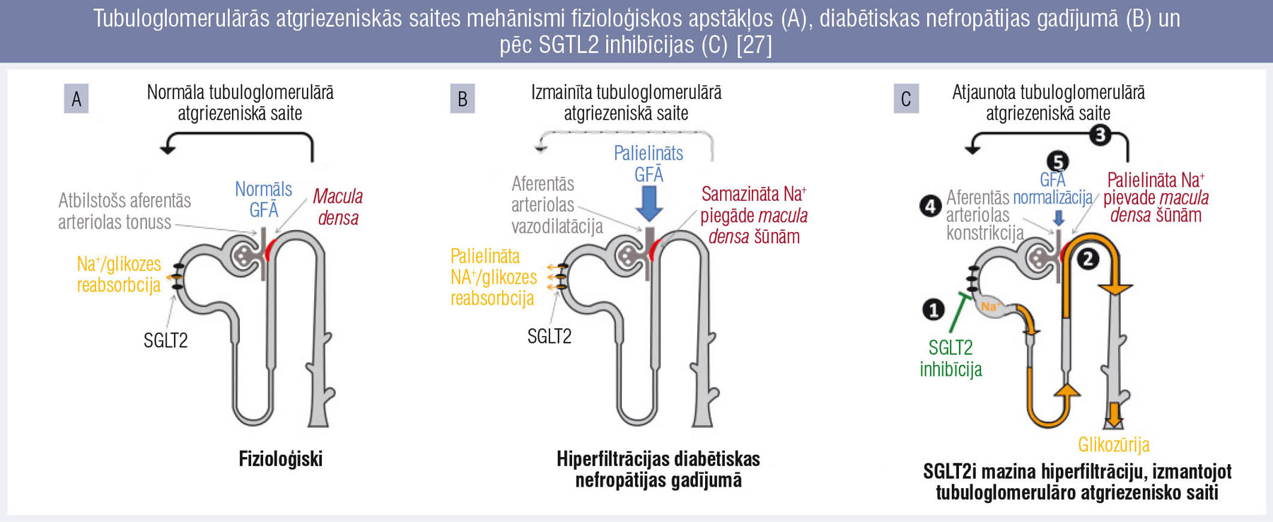 Tubuloglomerulārās atgriezeniskās saites mehānismi fizioloģiskos apstākļos (A), diabētiskas nefropātijas gadījumā (B) un pēc SGTL2 inhibīcijas (C) [27]