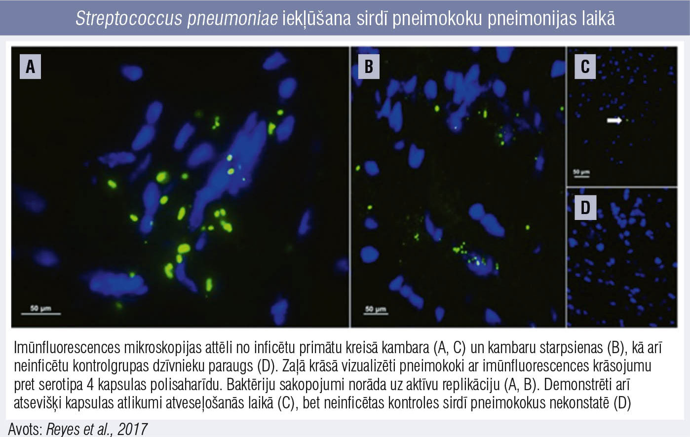 Streptococcus pneumoniae iekļūšana sirdī pneimokoku pneimonijas laikā