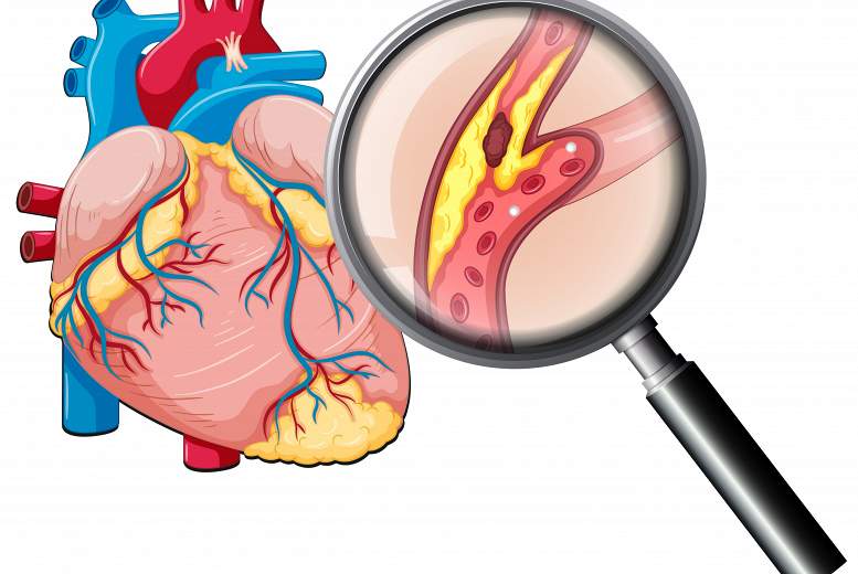 Lipoproteīna (a) loma dislipidēmijas korekcijā