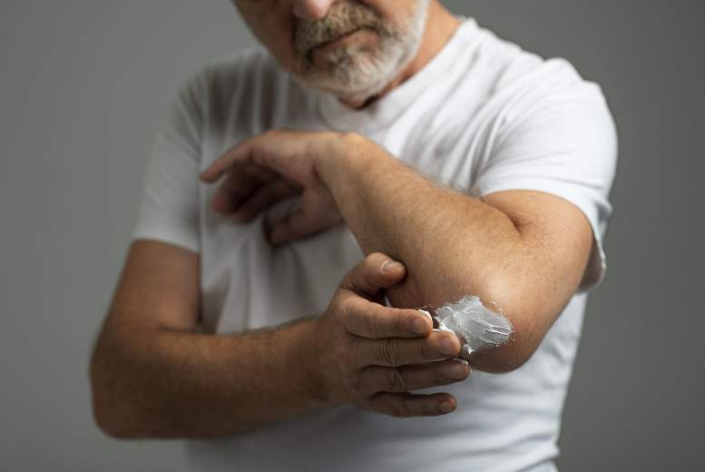 Sistēmiska psoriāzes terapija saistīta ar zemāku demences risku