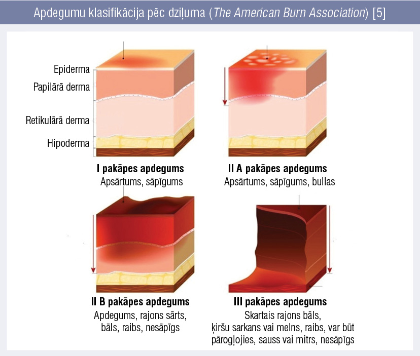 Apdegumu klasifikācija pēc dziļuma (The American Burn Association) [5]