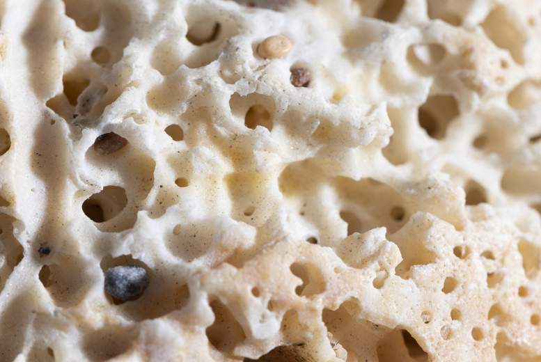 Sekundārās osteoporozes iemesli