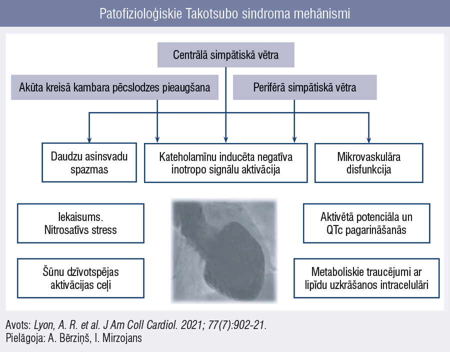 Patofizioloģiskie Takotsubo sindroma mehānismi