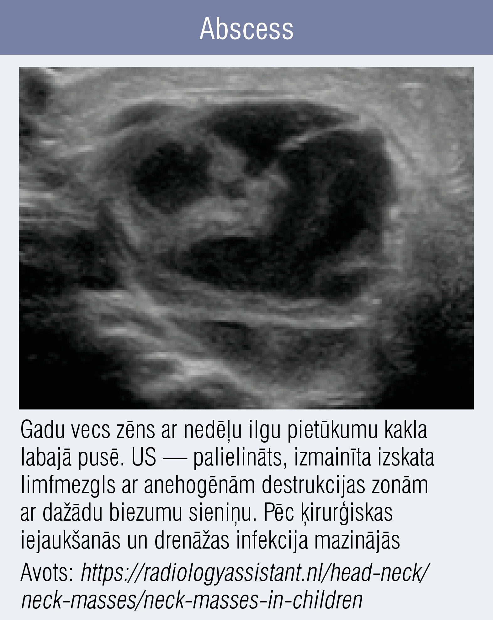 Abscess