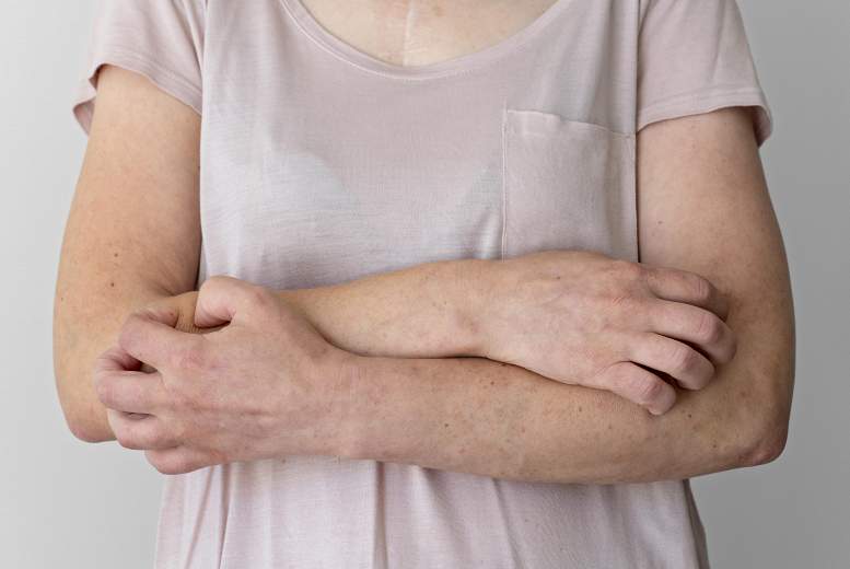 Atopiski stāvokļi ir saistīti ar biežākām ķirurģiskām komplikācijām pēc krūšu rekonstrukcijas un kaulu transplantācijas