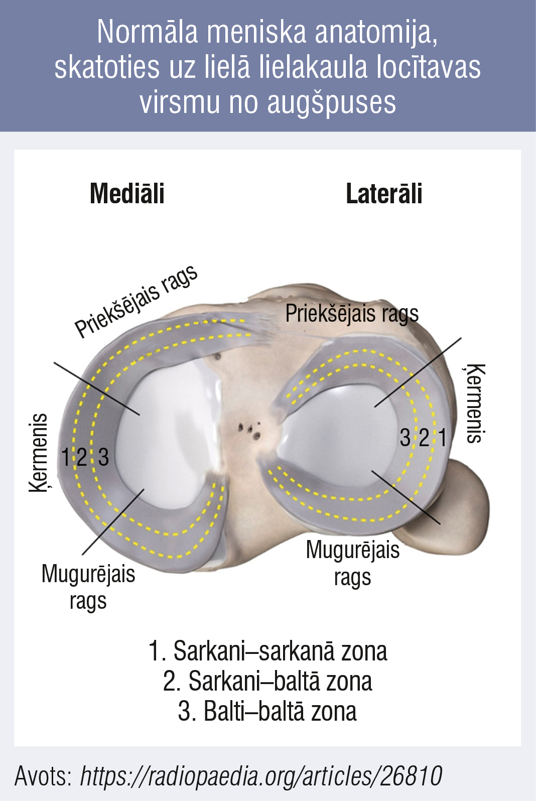 Normāla meniska anatomija, skatoties uz lielā lielakaula locītavas virsmu no augšpuses