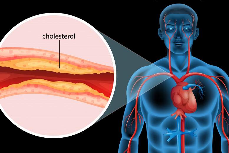 Lipīdus samazinoša terapija jauniem cilvēkiem