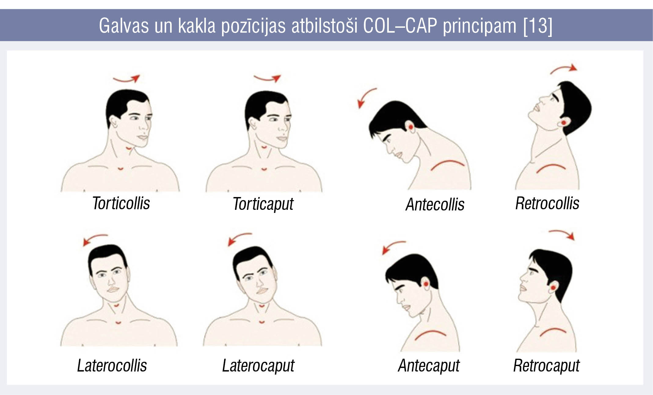 Galvas un kakla pozīcijas atbilstoši COL–CAP principam [13]