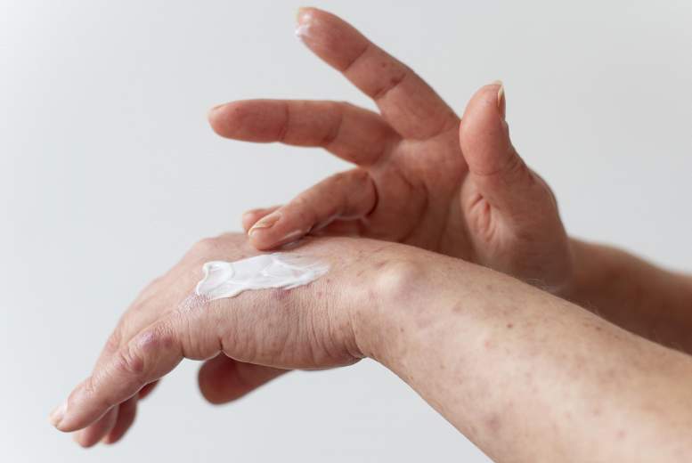 Vai bērnībā sācies atopiskais dermatīts atstāj ilgstošākas sekas nekā slimība, kas sākas pusaudža vecumā?