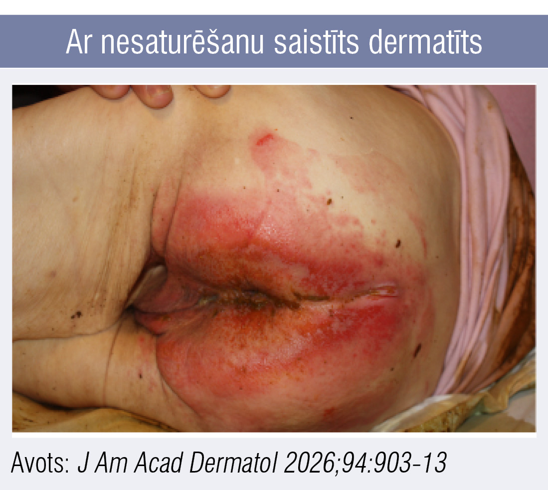 Ar nesaturēšanu saistīts dermatīts