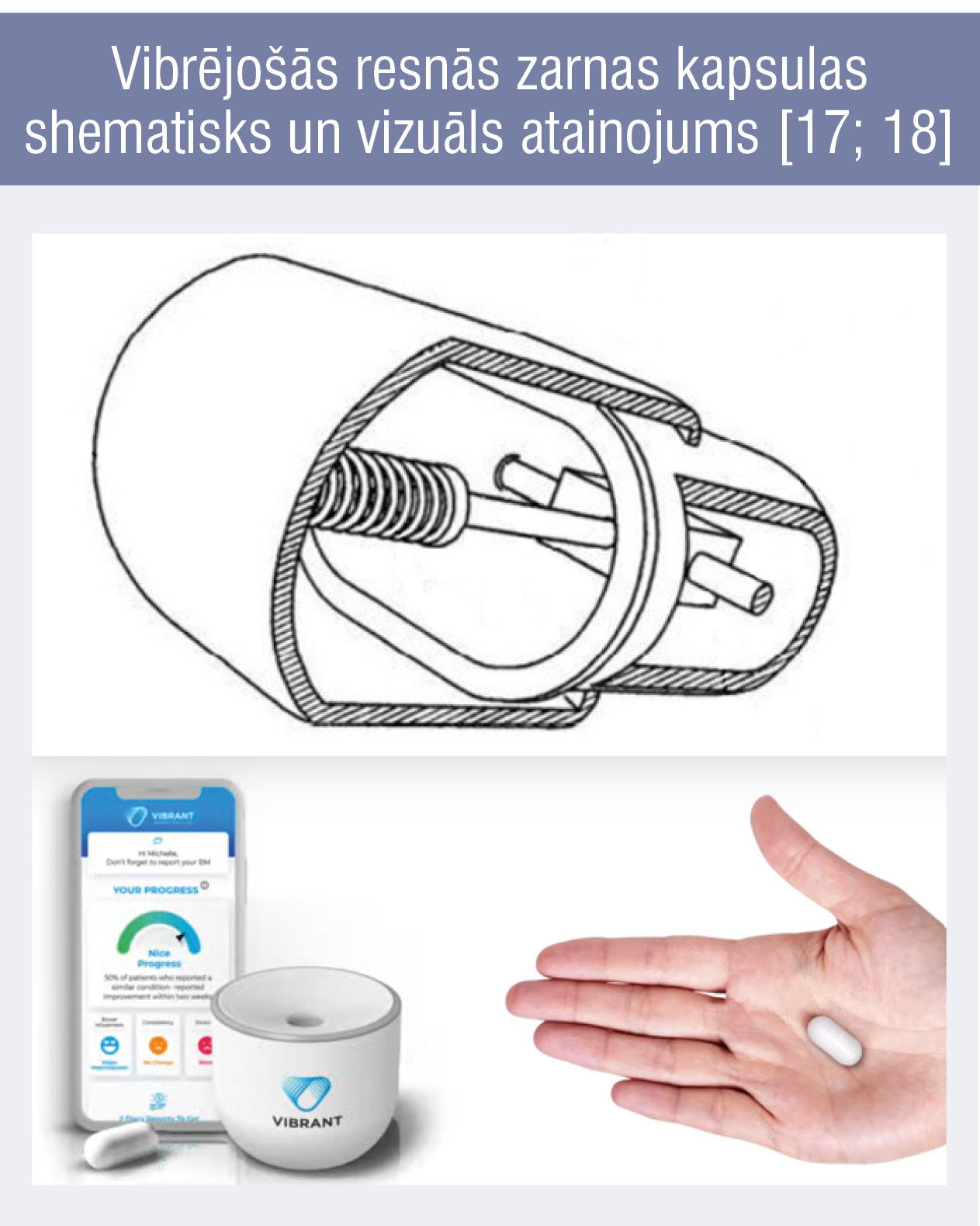 Vibrējošās resnās zarnas kapsulas
shematisks un vizuāls atainojums [17; 18]