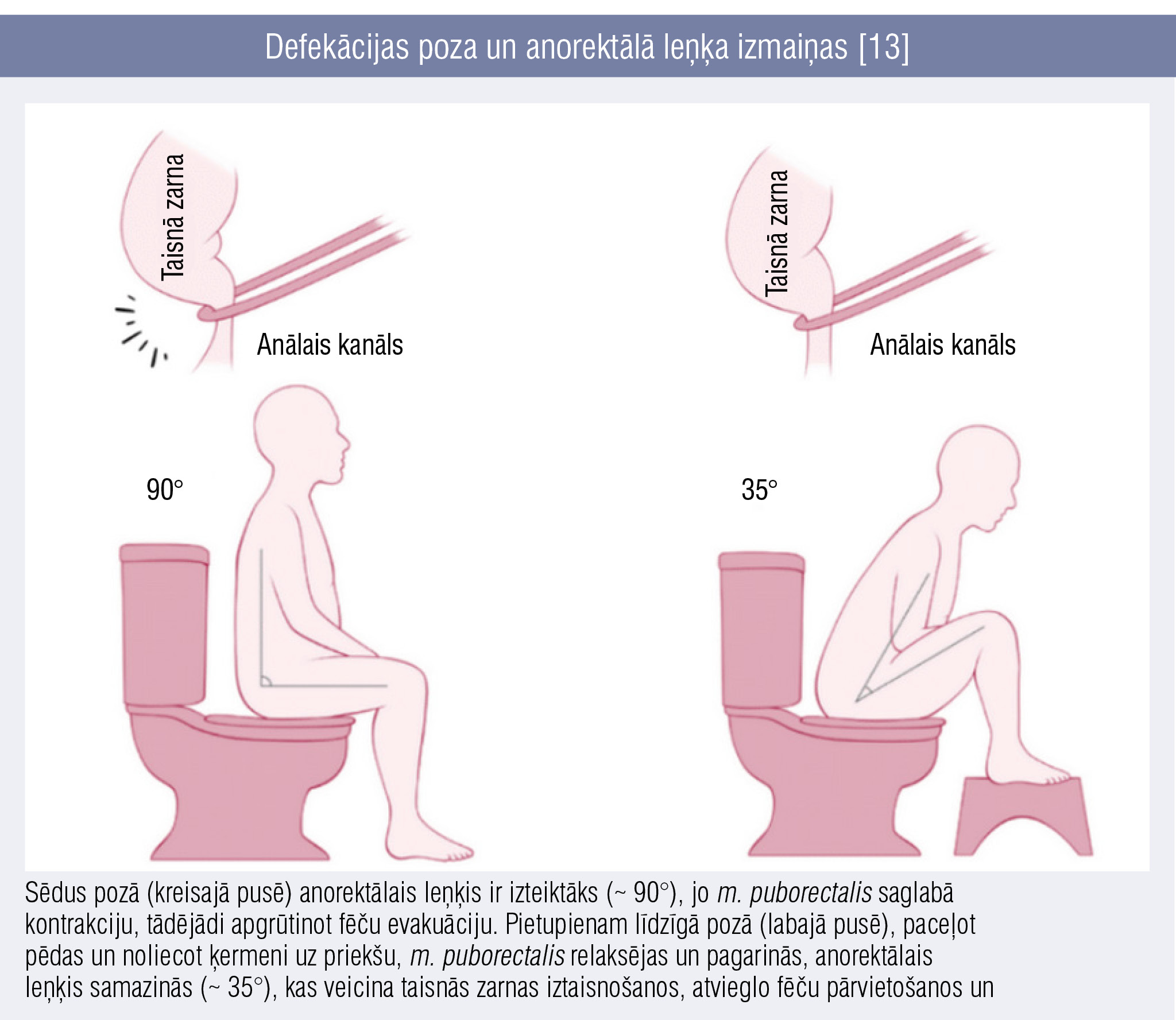 Defekācijas poza un anorektālā leņķa izmaiņas [13]