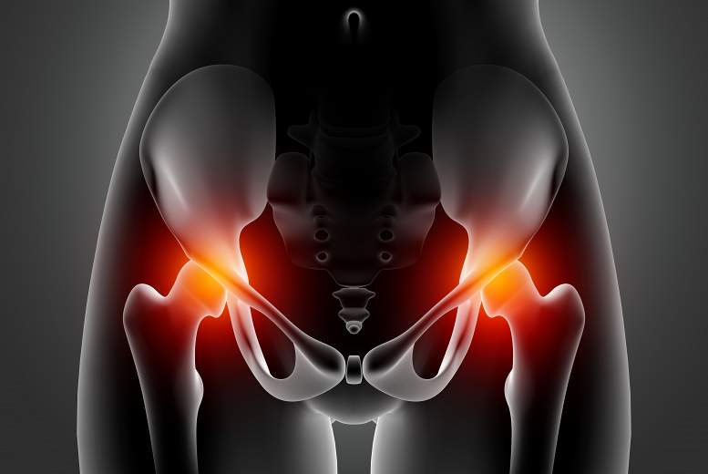 Sāpes gluteālajā apvidū. Komplicēta diferenciāldiagnostika