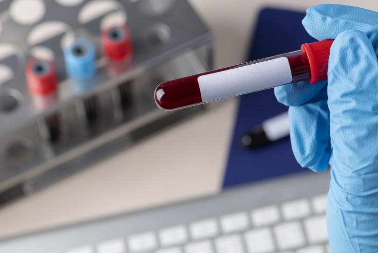 Hematoloģiska pacienta aprūpe un atpazīšana. Ģimenes ārsts vaicā hematologam