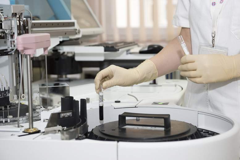 Šķidruma biopsijas vēža pārvaldībā: ctDNS loma recidīva izvērtēšanā